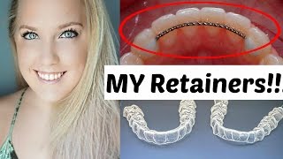 Retainers After Braces  Permanent and Temporary  Ashley Craig [upl. by Elockcin]