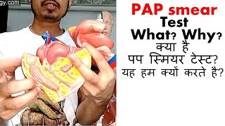 Pap smear test in Hindi [upl. by Ahseeyt]