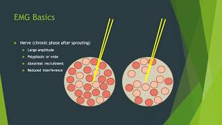 Exercise as a Treatment for Myositis [upl. by Dedrick]