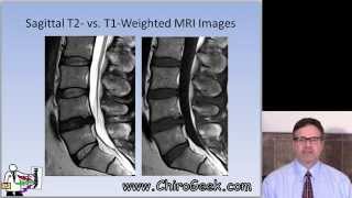 Normal Head CT Scan Anatomy Made Simple Neuroradiology [upl. by Yhpos992]