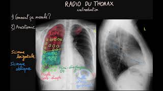 Radio du thorax  Introduction  Partie 1  Docteur Synapse [upl. by Llevert]