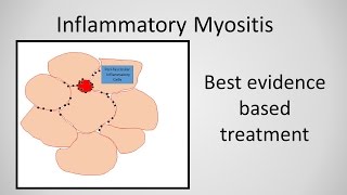 Duchenne Muscular Dystrophy Treatment [upl. by Nirehtac472]