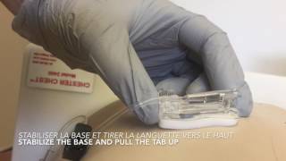 Removal gripper plus needle [upl. by Eniluqcaj]