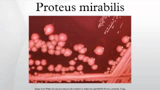 Proteus mirabilis [upl. by Olag]