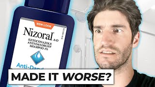 Nizoral Shampoo For Hair Loss  THE TRUTH [upl. by Annala104]