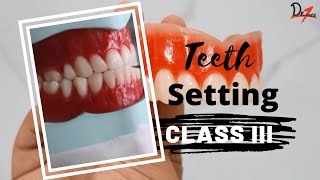 PROSTHODONTICS  Class Three Teeth Arrangement Made Easy [upl. by Navi]