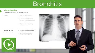 Pneumonia Introduction amp Types – Respiratory Medicine  Lecturio [upl. by Evilo]