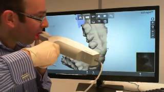 Intra Oral scanning with 3Shape TRIOS [upl. by Leachim]