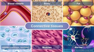 Osteosarcoma 101 Bone Pathology Basics [upl. by Eniak]