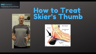 How to Treat Skiers Thumb [upl. by Eat]