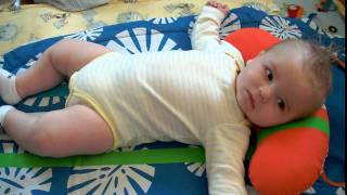 Evan six months infantile spasms  West Syndrome [upl. by Sosthina]