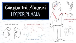 What is Congenital Adrenal Hyperplasia CAH [upl. by Leihcey]