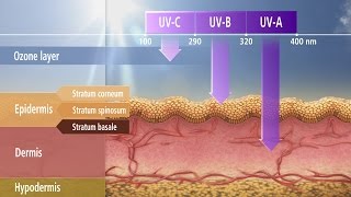 NonMelanoma Skin Cancer [upl. by Eaner]