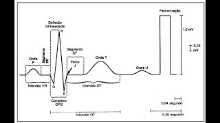 ECG Interpretation Tutorial  ChalkTalk 08  Basic Level [upl. by Otrebireh625]