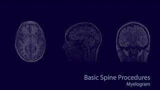 Cases in Radiology Episode 1 neuroradiology CT MRI [upl. by Lertnek]