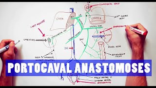 Portocaval Anastomoses  ANATOMY Tutorial [upl. by Jabon588]