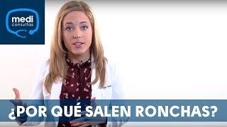 Ronchas ¿por qué aparecen MediConsultas [upl. by Etteraj282]