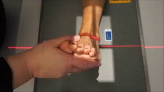 Ankle  AP Mortise Oblique and Lateral [upl. by Owiat]