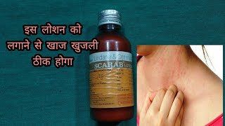 Scarab lotion  lindane and certified lotion  खाज खुलजी के दवा [upl. by Ymmik]