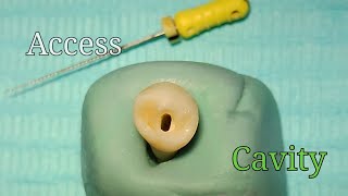 Access Cavity Preparation  Mandibular First Premolar [upl. by Stander]