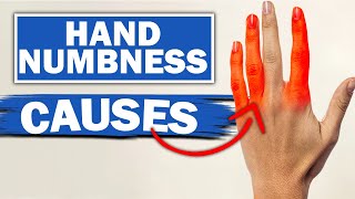 Numbness in Fingers and Toes  Dr Mark LeDoux  Top10MD [upl. by Aselehc]