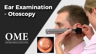 Otoscopy Ear Examination  ENT [upl. by Smukler2]