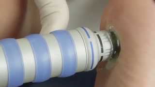 Shockwave Therapy or ESWT Explained [upl. by Salocin488]