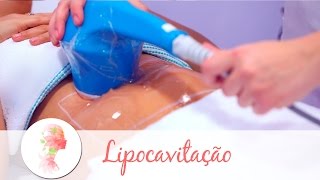 Lipocavitação tratamento estético reduz gordura localizada [upl. by Lala]