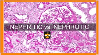 Nephritic vs Nephrotic Syndromes [upl. by Rondi]