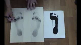 Natural Foot Orthotics Overview [upl. by Ingvar]