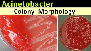 Acinetobacter Colony Morphology [upl. by Ahsinotna]