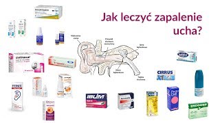 Jak leczyć zapalenie ucha [upl. by Toland]