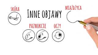 SKN Reumatologii Łuszczycowe Zapalenie Stawów ŁZS [upl. by Irat]