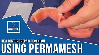 New Denture Repair Technique Using Perma Mesh By PREAT Corporation [upl. by Anauqahs548]