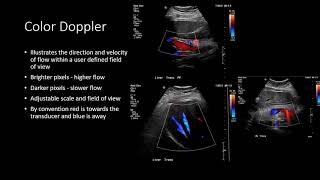 Ultrasound Physics  Types of Doppler Ultrasound [upl. by Bryner166]