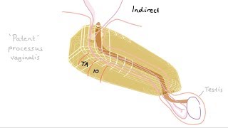 Anatomy of the inguinal region simplified [upl. by Nedearb]