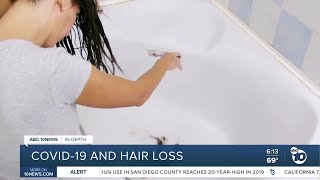 Indepth COVID19 and hair loss [upl. by Schaefer]