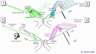 Non Surgical nonoperative treatment of hernia [upl. by Jelena]