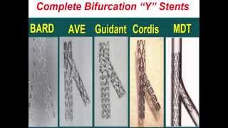 Bifurcation Lesions [upl. by Nedra448]