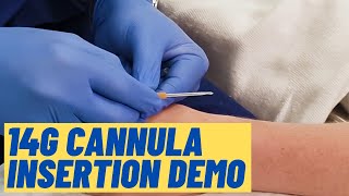 Large 14G cannula insertion technique  Live Demo [upl. by Feldman95]