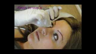 Permanent eyeliner  Makeup  Before and After  Tutorial by Redeem Clinic [upl. by Kelci]