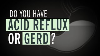 Symptoms and Treatment of Chronic Acid Reflux GERD [upl. by Ivan]