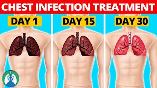 7 Natural Chest Infection Treatments Home Remedies [upl. by Orodoet15]