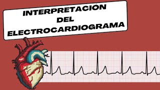 Interpretación del Electrocardiograma [upl. by Tyra]