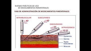 Administración de medicamentos por vía intradérmica y subcutánea [upl. by Gnilhsa]