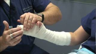 Splint Workshop 3  Ulnar Gutter Splint [upl. by Zebapda]