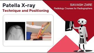 How to perform Patella Xray procedure Tangential sunrise view [upl. by Pierette]