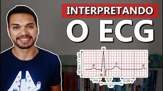 ONDAS DO ECG Cardio 06 [upl. by Emilie]