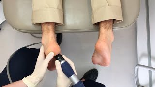 Shockwave Therapy Demonstration [upl. by Reiser601]