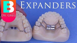 BRACES EXPLAINED Palatal Expanders [upl. by Kantos]